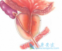 ǰ���ٰ����߷��ð�������(ABIRATERONE)�г��ֵ�Ѫ�صķ���