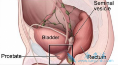 ǰ���ٰ�ҩ�����³��(ENZALUTAMIDE)�밢�������к�����