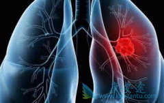 ���ڷΰ�������ɳ������Ҫ�ͻ���ҩ��һ��������