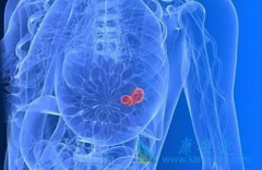 Ϊʲô������Ī����/ŵ�ߵ�ʿ���з����ӹ���Ĥ���ķ���