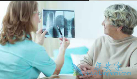 多发性骨髓瘤的症状 多发性骨髓瘤的症状