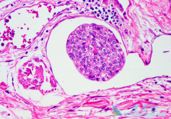 ��ķ����