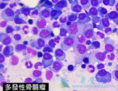 �෢�Թ��������߷�����������(bortezomib)������ļ�������