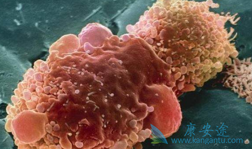 卡博替尼 卡博替尼