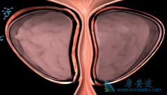 Ϊʲô����ǰ���ٰ����߸�ƫ��ӡ�Ȱ�������(ABIRATERONE)