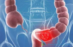 Ϊʲô�����������������������/�����ض�����Ч