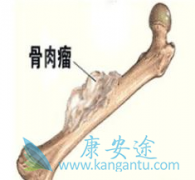 ����ҩ�ﰢ������(Apatinib)�����ƹ�������ת����