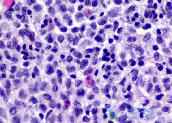 ���޷���