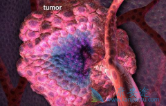 ��ά͡(Avastin)���µĹ���������ʲô֢״����