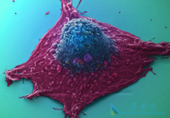 ��������(Caprelsa)�ڷ�Сϸ���ΰ��������к�����֮��