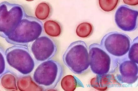 雷利米得 雷利米得