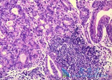 奥沙利铂 奥沙利铂