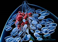 ��ɳ����(Eloxatin)�����漪�������������ٰ���