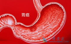 ������(REGORAFENIB)���ӳ�����θ�����������ڷ�����Ǳ������