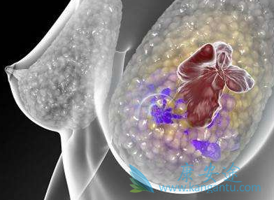 帕博西尼 帕博西尼