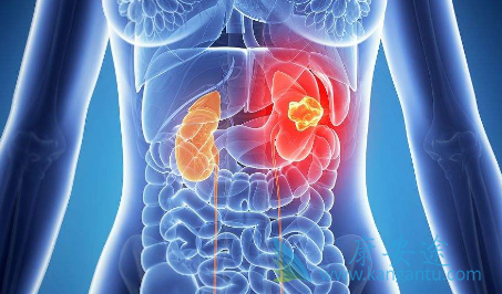 阿昔替尼 阿昔替尼