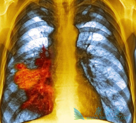 尼妥珠单抗 尼妥珠单抗