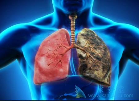 非小细胞肺癌 非小细胞肺癌