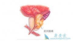 ǰ���ٰ��ķ������ؼ�ת��;������Щ