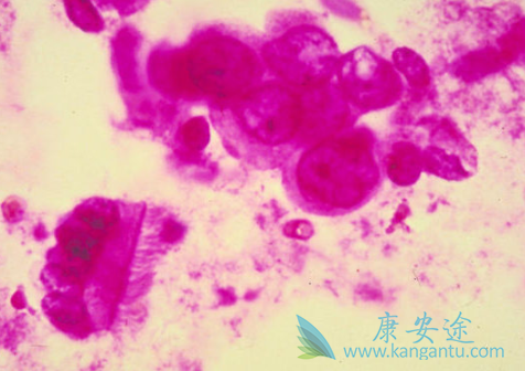 ��Ī����