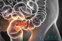 ���ᵥ��(Panitumumab)���뻯�����϶�������ת���Խ�ֱ������