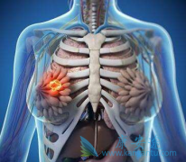 ����ͬ�����Ϻ���͡(Herceptin)��������ٰ�����DFS������