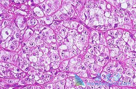 奥拉帕尼 奥拉帕尼