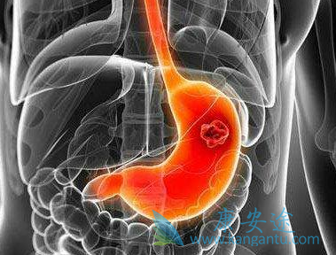 奥拉帕尼 奥拉帕尼