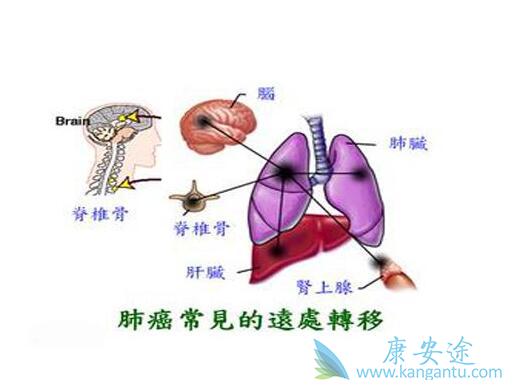 �ΰ���ת��