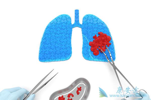 �ΰ����Ʒ���