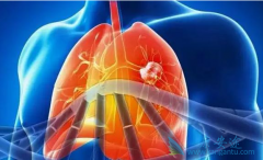 ����ܹ����ٷ�Сϸ���ΰ������еķ����Է�����