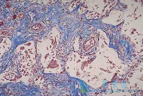 ������ͪ