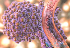 PD-1ҩ��ŷ����/���䵥���������޿��Է�Сϸ���ΰ��Ŀ�����Ϊ65%