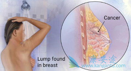 �������ٰ�����