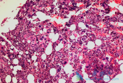 ����ҩ��³������(jakavi)�����еĹ�����ά�����߶���Ч��