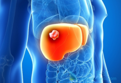 ��������(cabozantinib)����߸ΰ����ߵ�����������