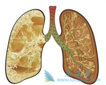 ������ͪ