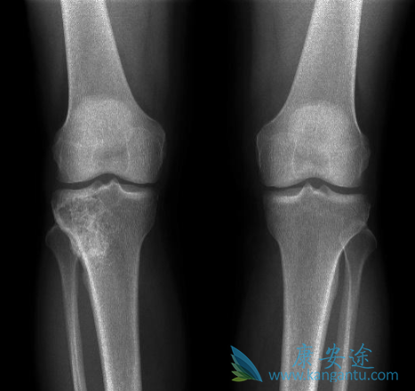 ��ŵ����