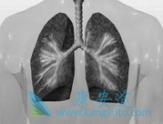 ӡ�����޿�(Erlonat)����Щҩ��ͬʱ���ûή������Ч��