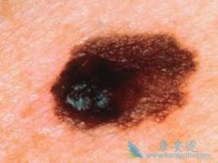 ��ɫ������ʲô����ɫ��������ЩΣ����