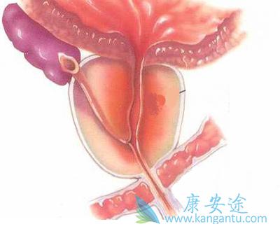 ���װ�����