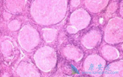 ��������(Gemcitabine)�ڻ�����ܰ����е�����Ч��