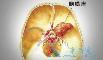 ��Ĥ������