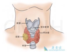 ��״������֢״����Щ���粻��ʱ���ƻ�����ЩΣ����