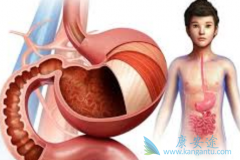 θ�����������������������������ЧӦ���Ӧ����������չ