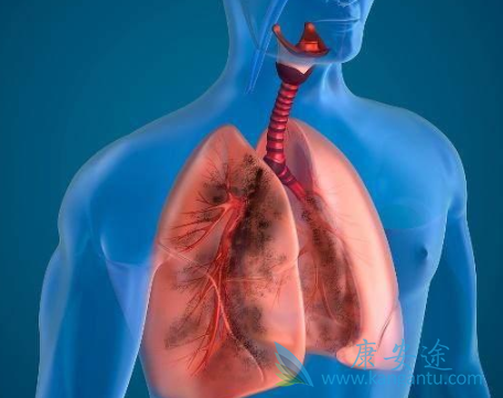 布加替尼 布加替尼