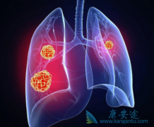 ��������(Entrectinib)��ROS1������Ч���ȿ�������ǿ