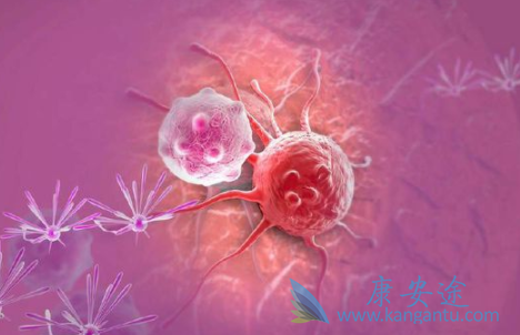 胃肠道间质瘤 胃肠道间质瘤