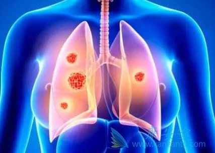 恩曲替尼 恩曲替尼