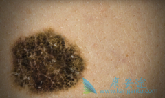 ���������������������ʹ���ֺ�ɫ��������ʵ���ٴ�����